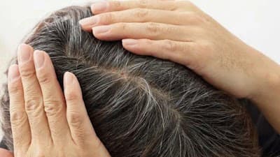 方源毛囊育髮保健spa 照片 1